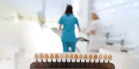 are-porcelain-veneers-worth-it.