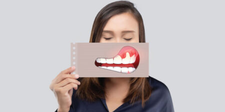 What-is-gum-disease-(periodontitis)