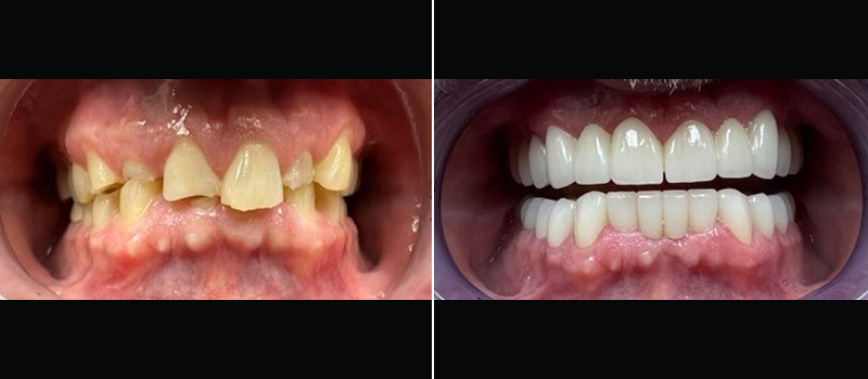 beforeafter13