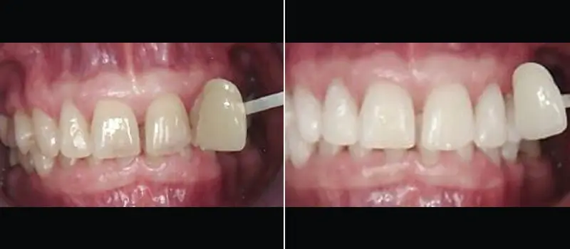 beforeafter1